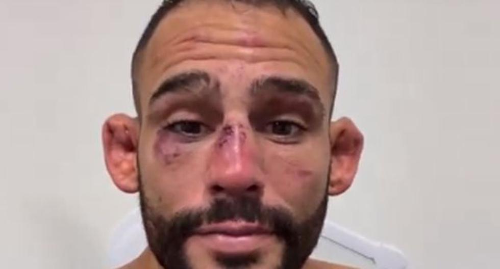 Dura derrota de Ponzinibbio: así quedó su rostro tras combate con Michel Pereira 