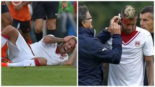 Jeremy Ménez sufrió una impactante lesión en su oreja derecha