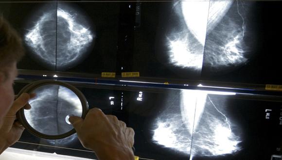 Encuentran relación entre cánceres de mama y útero