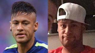 Neymar con paperas: así luce el rostro del crack del Barcelona