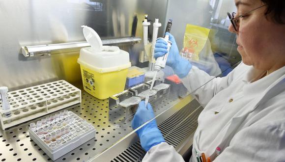 Un asistente de laboratorio prepara una prueba para el coronavirus en el hospital Amedeo di Savoia en Turín, Italia. (Foto: EFE).