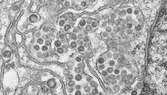 MERS: Científicos identifican anticuerpos del coronavirus