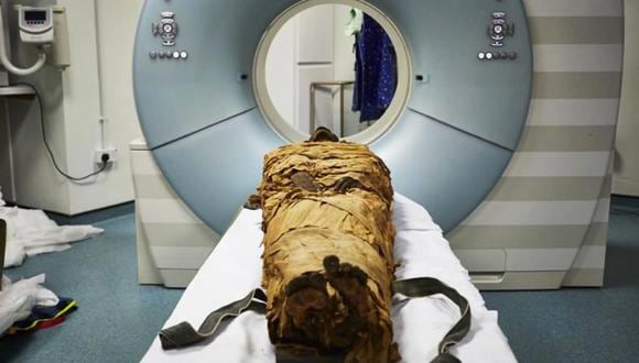 El cuerpo momificado de Nesyamun. (Leeds Teaching Hospitals / Leeds Museos y Galerías.)