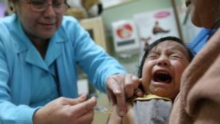 Sarampión: vacunación desde este lunes en Lima, Callao y Cusco