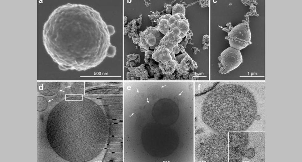 Tras 12 años de trabajo, biólogos japoneses han logrado cultivar el microbio 'Lokiarchaeota', que sería el precursor de las células eucariotas. (Foto: bioRxiv)