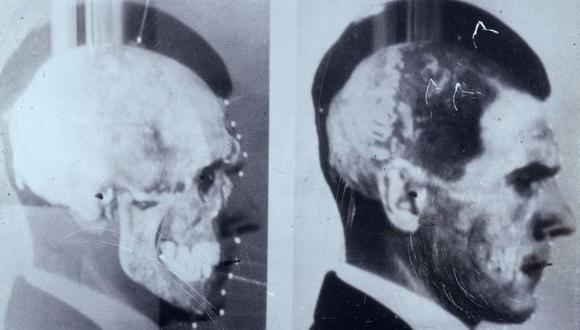 En 1985 científicos alemanes utilizaron una técnica innovadora de sobreponer imágenes para confirmar que el cráneo exhumado en Embu era de Josef Mengele. (Foto: Maja Helmer)