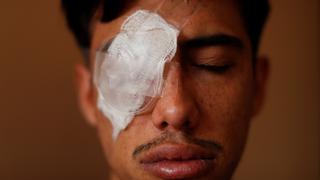 Muertos, gases tóxicos y jóvenes sin ojos: la cara más oscura de las protestas en Chile | FOTOS 