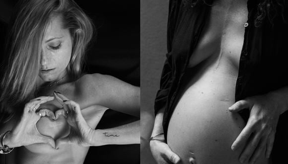 Como casi todas las mujeres retratadas, Helen mostró por primera vez las marcas que el cáncer dejó en su cuerpo . A la izquierda, Lucía y la huella de una operación a pecho abierto.
