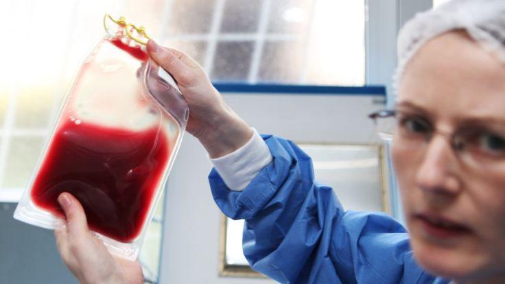 Los portadores de sangre Rh nulo pueden padecer anemia leve. (Foto: CHOJA)