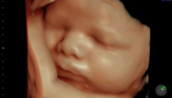 Ecografía 6D permite ver imágenes del bebe desde el celular