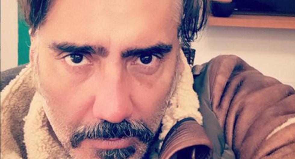 Alejandro Fernández se recupera tras operación por gangrena. (Foto: Instagram @alexoficial)