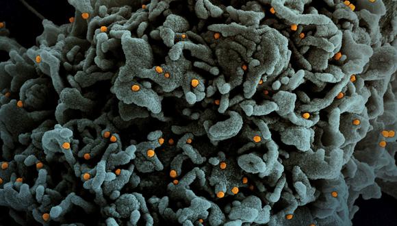 This National Institute of Allergy and Infectious Disease(NIAID) handout photo obtained March 31, 2021 shows a colorized scanning electron micrograph of a cell (teal) infected with UK B.1.1.7 variant SARS-CoV-2 virus particles (orange), isolated from a patient sample. (Photo by Handout / National Institute of Allergy and Infectious Diseases / AFP) / RESTRICTED TO EDITORIAL USE - MANDATORY CREDIT "AFP PHOTO /NATIONAL INSTITUTE OF ALLERGY AND INFECTIOUS DISEASES/HANDOUT " - NO MARKETING - NO ADVERTISING CAMPAIGNS - DISTRIBUTED AS A SERVICE TO CLIENTS
