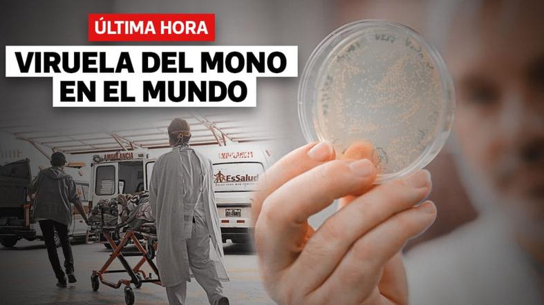 Virus de la viruela del mono en el Mundo, hoy: última hora, casos y más