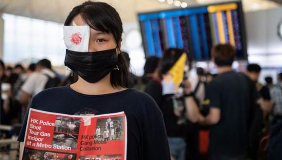 Los parches en el ojo son un símbolo de protesta entre los manifestantes en Hong Kong. (Foto: EFE)