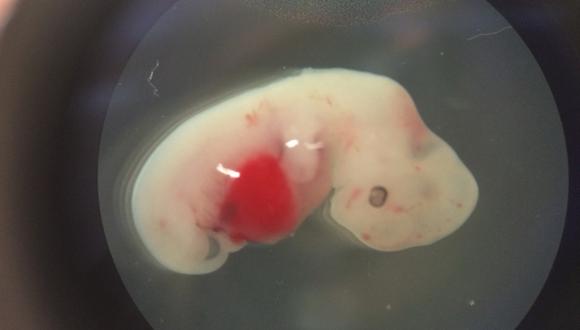 Esta foto, proporcionada por el Instituto Salk, muestra en emrbi&oacute;n de cerdo de cuatro semanas que ha sido inyectado con c&eacute;lulas madre humanas. (Foto: Instituto Salk/AP)