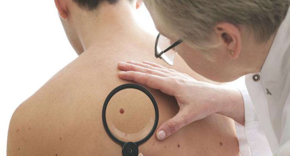 Protégete del cáncer de piel. (Foto: ThinkStock)