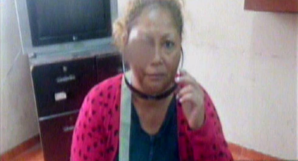 Mujer quedó con el rostro hinchado tras agresión. (Foto: Captura América Noticias)