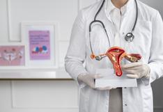 Cáncer de cuello uterino: ¿cómo se relaciona con el virus del papiloma humano y cómo diagnosticarlo a tiempo?