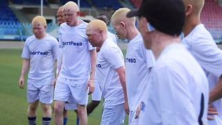 Tanzania: El equipo de albinos que utiliza el fútbol para combatir la violencia racial[VIDEO]