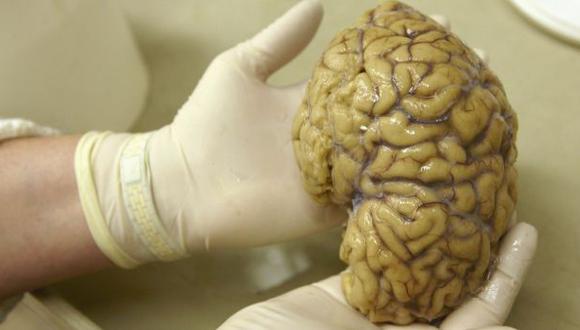 Tener un cerebro grande no es necesariamente una buena noticia