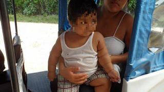 Bebe de 16 kilos llegó a Lima para que médicos evalúen su salud