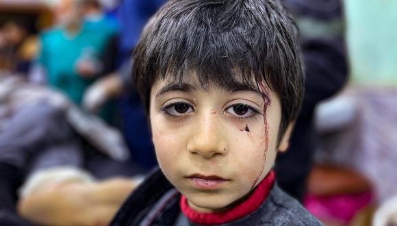 Un niño herido espera tratamiento en el hospital Bab al-Hawa luego de un terremoto, en la zona rural del norte de la provincia de Idlib en Siria, controlada por los rebeldes, en la frontera con Turquía, a principios del 6 de febrero de 2023. (Foto: Aaref WATAD / AFP)