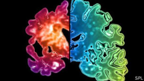 Científicos proponen prueba cutánea para detectar Alzheimer