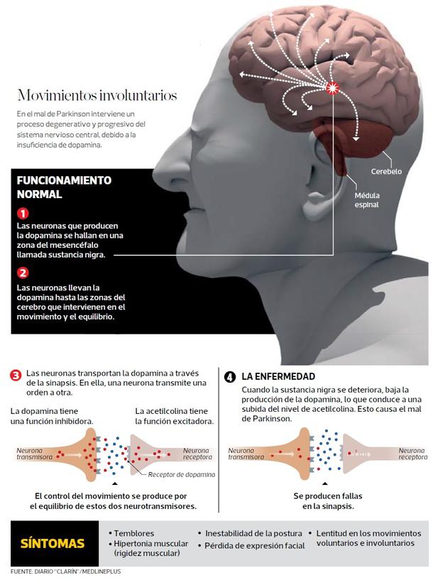 Una Nueva Mirada Al Mal De Parkinson Tecnologia El Comercio Per