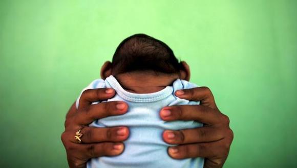 Brasil: zika pueda causar microcefalia en 1 de cada 7 embarazos