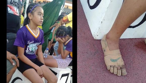 La historia de la niña filipina que ganó tres medallas de oro con los pies vendados. (Foto: Facebook/Predirick B. Valenzuela)
