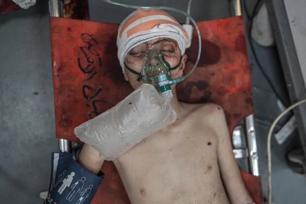 Un niño palestino herido en un bombardeo israelí recibe tratamiento en el Hospital de los Mártires de Al-Aqsa en Deir el-Balah, en el centro de Gaza, el 22 de abril de 2024. (Foto de AFP)