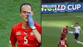 La terrible patada que obligó a jugador suizo dejar el campo