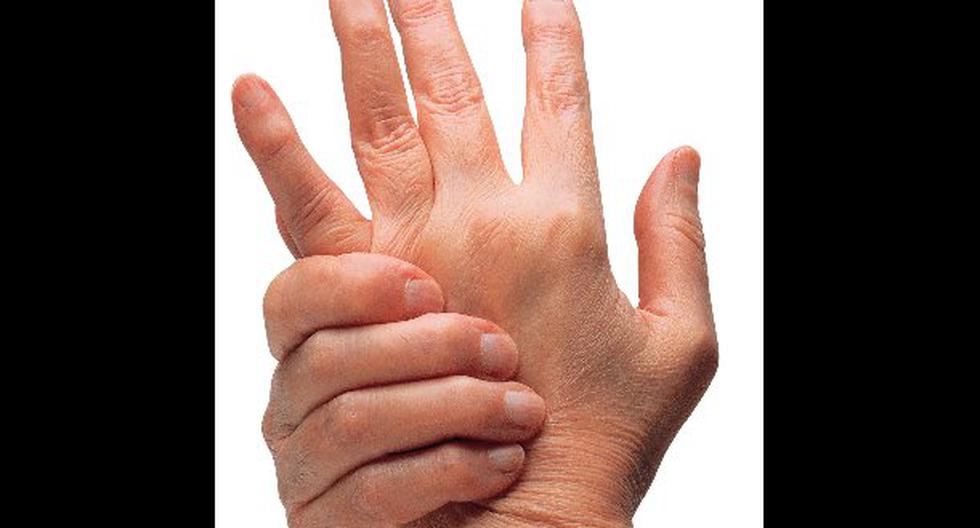 Nuestras manos nos darían señales sobre posibles enfermedades. (Foto: ThinkStock)