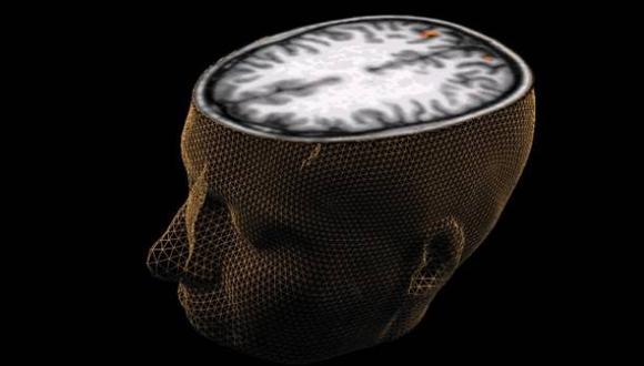 Las personas con un cerebro de tama&ntilde;o anormal tienen un rendimiento intelectual menor que el promedio. (Foto: Reuters)