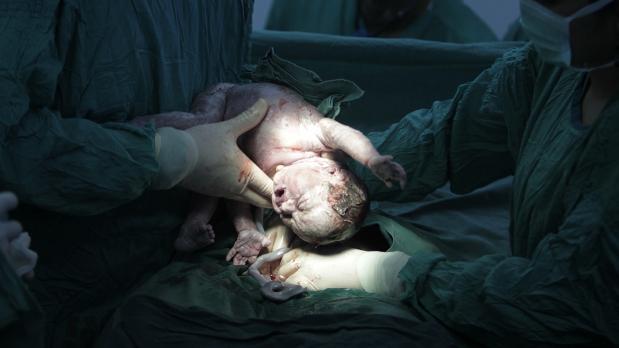 Encuentran bacterias que viven en placentas de embarazadas