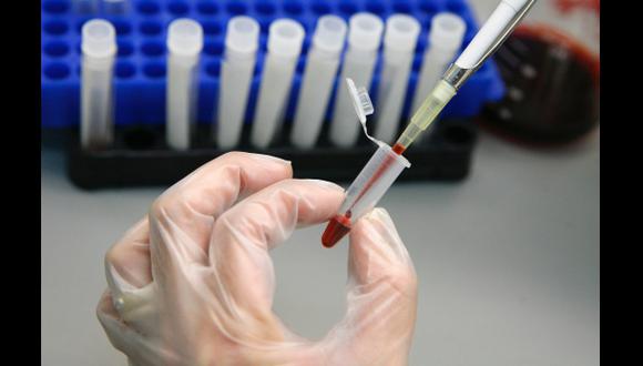 Médicos mexicanos más cerca de crear una vacuna contra el VIH