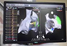 Mujer se recupera de mal cardíaco con ayuda de moderno navegador 3D | VIDEO