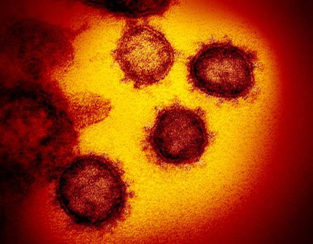 Esta imagen muestra las espículas, que son las proyecciones proteicas que rodean al virus. Estas forman lo que parece una corona. A esto se debe la denominación "coronavirus". (Foto: NIAID)