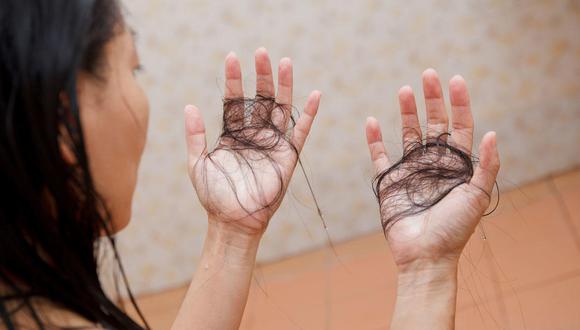 Según estudios, alrededor del 60% de mujeres pueden reportar caída del cabello, mientras que solo el 20% de varones presenta el mismo problema. (Foto: GEC/referencial)