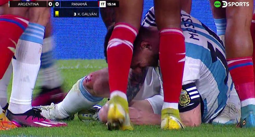 They left his knee bleeding: the harsh foul that Messi received in Argentina vs. Panama | VIDEO