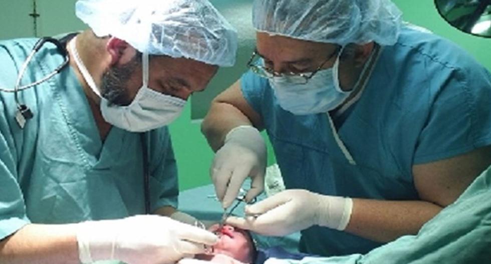Perú. Operarán gratuitamente a personas con fisuras en el labio y el paladar. (Foto: Agencia Andina)
