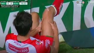 Jugada de alto impacto: la terrible lesión que sufrió Bilbao en el Necaxa vs. San Luis | VIDEO
