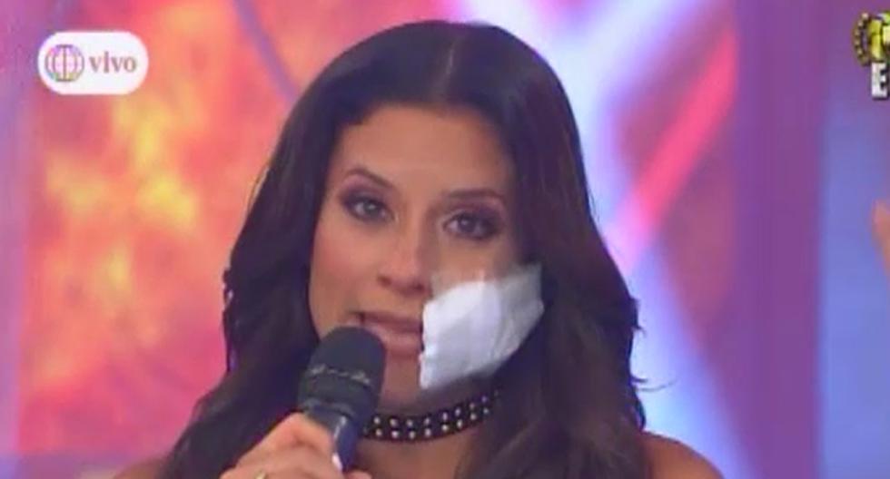 María Pía Copello apareció con un parche en el rostro por este motivo. (Foto: Captura América TV)