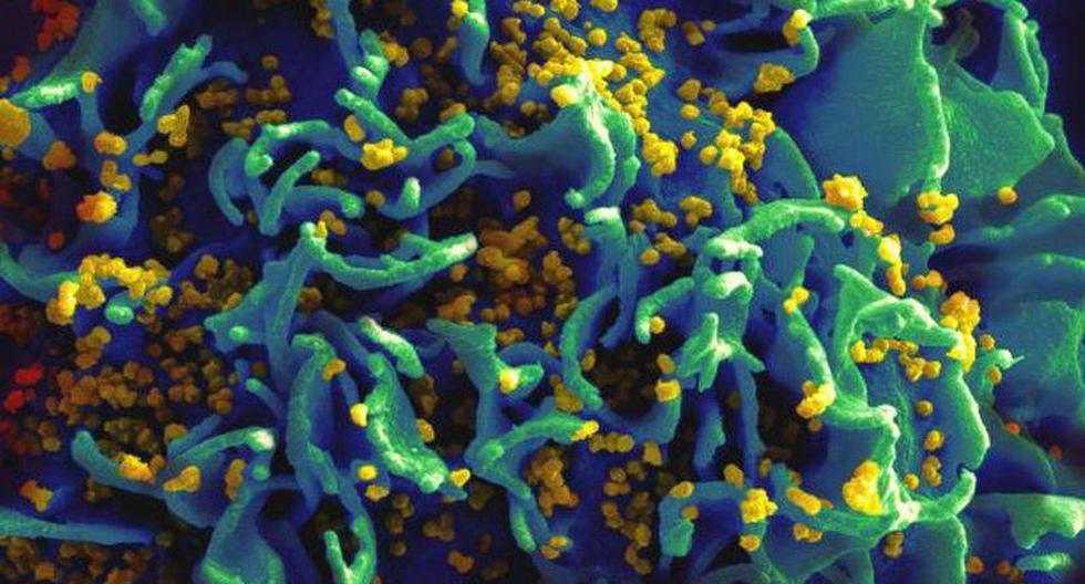 Célula infectada con el VIH. (Foto: flickr.com/niaid)