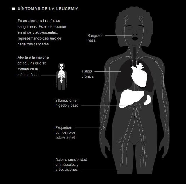 Tipos de cáncer más frecuentes en Perú [Especial multimedia] - 2
