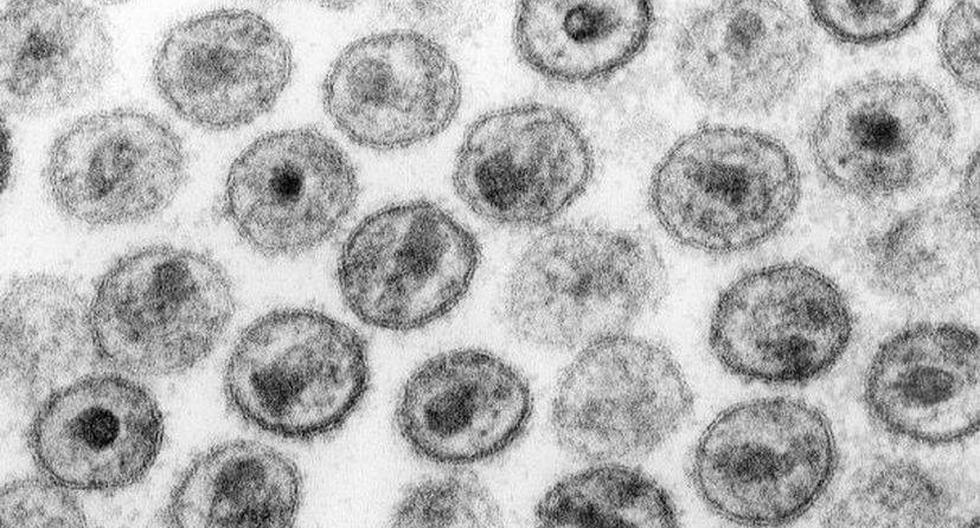 Virus del VIH. (Foto: Wikimedia)