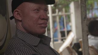 El riesgo de ser albino en Tanzania