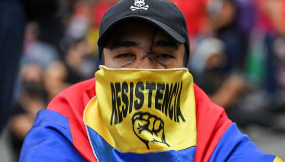 Un manifestante herido durante las protestas participa en la inauguración de un monumento a la resistencia construido por manifestantes y lugareños en Cali, Colombia, el 13 de junio de 2021. (LUIS ROBAYO / AFP).