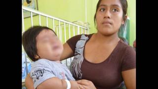 Bebe de 16 kilos que vino de Tarapoto no tendría problemas hormonales