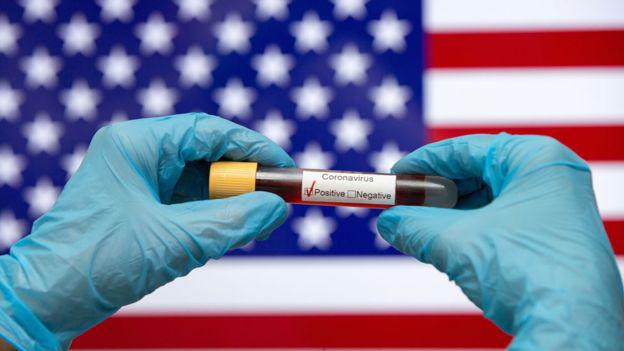 Estados Unidos está muy lejos de la cantidad de testeos por coronavirus que aconsejan los expertos. (Getty Images).